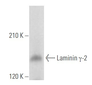 Anti Laminin Antibody E