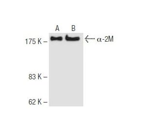 α-2M Antibody (2D9) - Western Blotting - Image 62835