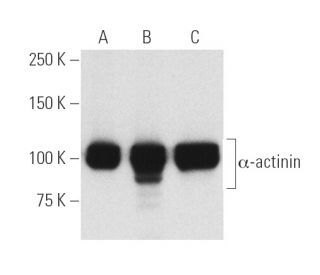 α-actinin Antibody (H-2) - Western Blotting - Image 5157