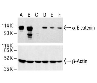 &alpha; E-catenin Antibody (G-11) - Western Blotting - Image 412261 