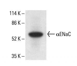 αENaC Antibody (H-6) - Western Blotting - Image 411773The Double Nickase Plasmid features a U6 promoter for sgRNA expression, a 20 nt targeting sequence, and a gRNA scaffold to guide Cas9n. It includes a CBh promoter for Cas9n (D10A) and puromycin resistance, GFP for transfection verification, and nuclear localization signals (NLS). The 2A peptide allows co-expression of Cas9n and Puro from a single promoter, enabling precise genome editing with reduced off-target effects.