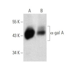 α-gal A Antibody (C6) - Western Blotting - Image 374581SAM Transcription Activation: SAM system utilizing dCas9-VP64, MS2-P65-HSF1, and sgRNA for precise gene transcription activation.