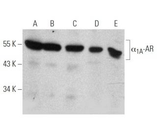α<sub>1A</sub>-AR Antibody (4D8) - Western Blotting - Image 366640Each CRISPR/Cas9 Knockout (KO) Plasmid product consists of a pool of 3 plasmids designed to ensure identification and cleavage of a specific gene for maximum knockout efficiency. Each plasmid encodes a unique 20 nt sequence derived from the GeCKO (v2) library.