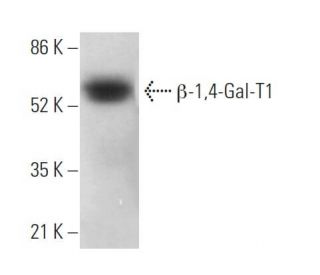 β-1,4-Gal-T1 Antibody (A-3) - Western Blotting - Image 373457