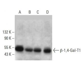 β-1,4-Gal-T1 Antibody (A-3) - Western Blotting - Image 381116