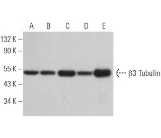 &beta;3 Tubulin Antibody (2G10) - Western Blotting - Image 379358 