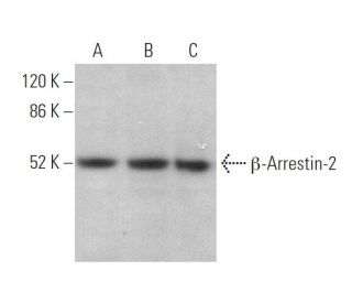 β-Arrestin-2 Antibody (D-5) - Western Blotting - Image 373048