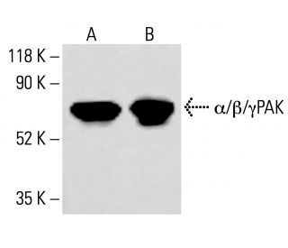 &alpha;/&beta;/&gamma;PAK Antibody (D-8) - Western Blotting - Image 413728Each CRISPR/Cas9 Knockout (KO) Plasmid product consists of a pool of 3 plasmids designed to ensure identification and cleavage of a specific gene for maximum knockout efficiency. Each plasmid encodes a unique 20 nt sequence derived from the GeCKO (v2) library. 