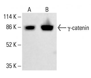 &gamma;-catenin Antibody (15F11) - Western Blotting - Image 413032 