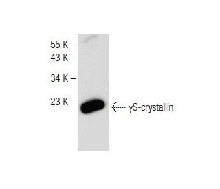 γS-crystallin Antibody (A-3) - Western Blotting - Image 149625Each CRISPR/Cas9 Knockout (KO) Plasmid product consists of a pool of 3 plasmids designed to ensure identification and cleavage of a specific gene for maximum knockout efficiency. Each plasmid encodes a unique 20 nt sequence derived from the GeCKO (v2) library.
