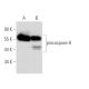 caspase-8 (4.1.20): sc-73526. Western blot analysis of procaspase-8 expression in untreated (A) and 1-b-D-Arabino furanosy