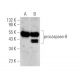 caspase-8 (C-20): sc-6136. Western blot analysis of caspase-8 expression in untreated (A) and 1-β-D-Arabino furanosylcytos 