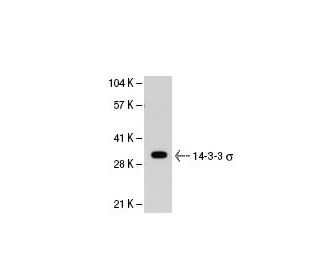 14-3-3 σ Antibody (5D7) - Western Blotting - Image 21562 