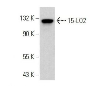 15-LO2 Antibody (H-6) - Western Blotting - Image 359207 