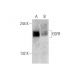 17-AAG: sc-200641. Western blot analysis of EGFR expression in untreated (A) and 17-AAG treated (B) T98G whole cell lysate 