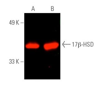 17&beta;-HSD Antibody (D-8) - Western Blotting - Image 389950 