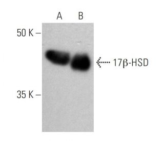 17&beta;-HSD Antibody (A-5) - Western Blotting - Image 370726 