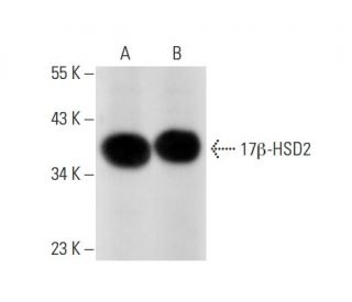 17&beta;-HSD2 Antibody (E-7) - Western Blotting - Image 301700 