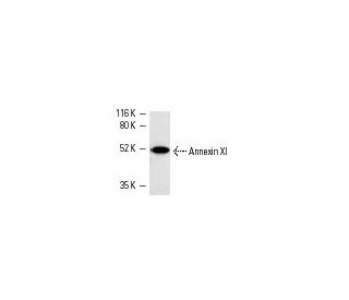 3611-RF nuclear extract: sc-2143. Western blot analysis of Annexin XI... 