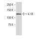 4.1B Antibody (485) - Western Blotting - Image 34011