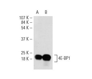 4E-BP1 Antibody (11G12C11) - Western Blotting - Image 17836 