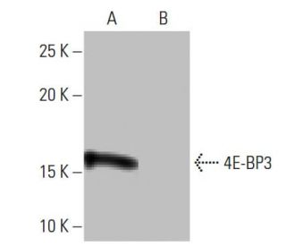 4E-BP3 Antibody (4-RY9) - Western Blotting - Image 64800