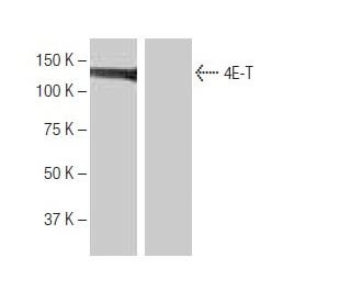 4E-T Antibody (Y-2D28) - Western Blotting - Image 64801