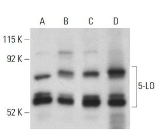 5-LO Antibody (33) - Western Blotting - Image 399008 
