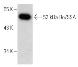 52 kDa Ro/SSA Antibody (E-11) - Western Blotting - Image 354714 