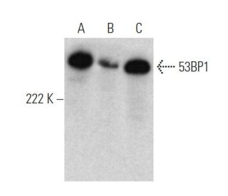 53BP1 Antibody (6B3E10) - Western Blotting - Image 374540 