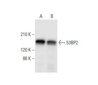 53BP2 Antibody (H-4) - Western Blotting - Image 303758 