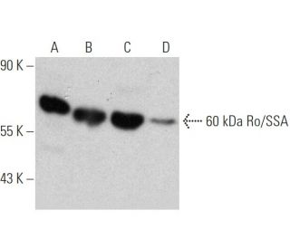 60 kDa Ro/SSA Antibody (AA-3) - Western Blotting - Image 368253