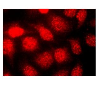 8-oxoG DNA Lesion Antibody (483.15) - Immunofluorescence - Image 142935