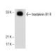 A-10 Cell Lysate: sc-3806. Western blot analysis of bradykinin B1...