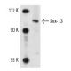 A-10 nuclear extract: sc-24959. Western blot analysis of Sox-13 expression...