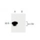 A-431 + AP Cell Lysate: sc-24651. Western blot analysis of...