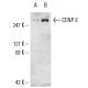 A-431 + Calyculin A Cell Lysate: sc-2260. Western blot analysis...