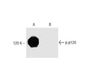 A-431 + Calyculin A Cell Lysate: sc-2260. Western blot analysis... 