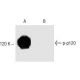 A-431 + Calyculin A Cell Lysate: sc-2260. Western blot analysis... 
