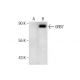 A-431 + EGF Whole Cell Lysate: sc-2202. Western blot analysis...