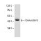 Cytokeratin 8 Antibody (A-9) - Western Blotting - Image 149634