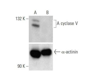 A cyclase V Double Nickase Plasmid (h): sc-401391-NIC-2. Western blot analysis of A cyclase V expression in non-transfecte 