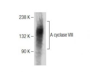 Adenylate cyclase 8/AC8/ADCY8 Antibody (B-4) - Western Blotting - Image 284508