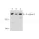 Adenylate cyclase 10/ADCY10 Antibody (B-1) - Western Blotting - Image 344118