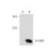 A-FABP (B-4): sc-271529. Western blot analysis of A-FABP expression in... 