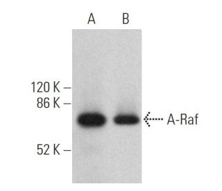 A-Raf Antibody (A-5) - Western Blotting - Image 359723