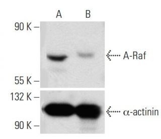 A-Raf siRNA (h): sc-29615. Western blot analysis of A-Raf expression in non-transfected control (A) and A-Raf transfected 
