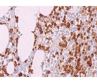 A1 Antibody (B-3) - Immunohistochemistry - Image 375186 