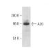 A20/TNFAIP3 Antibody (8E8.38) - Western Blotting - Image 10671