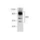 A20/TNFAIP3 Antibody (B-5) - Western Blotting - Image 156423 
